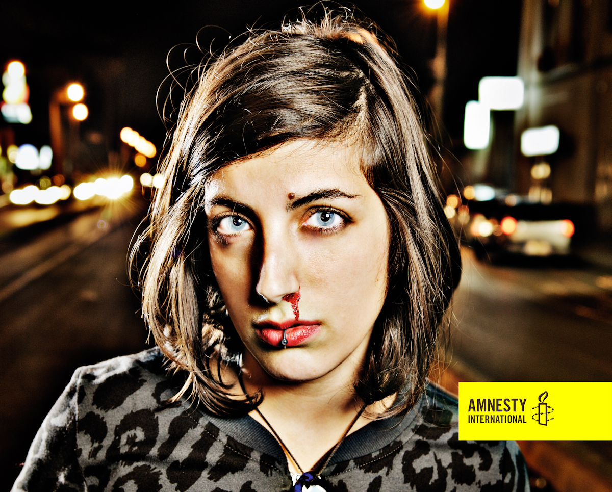 Painsharing in mostra per Amnesty International